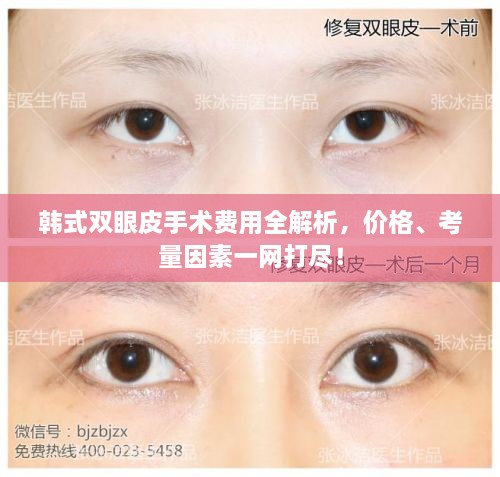 韓式雙眼皮手術(shù)費(fèi)用全解析，價(jià)格、考量因素一網(wǎng)打盡！