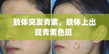 肢體突發(fā)青紫，肢體上出現(xiàn)青紫色斑 