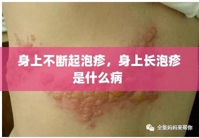 身上不斷起泡疹，身上長泡疹是什么病 