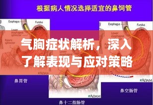 氣胸癥狀解析，深入了解表現(xiàn)與應(yīng)對(duì)策略