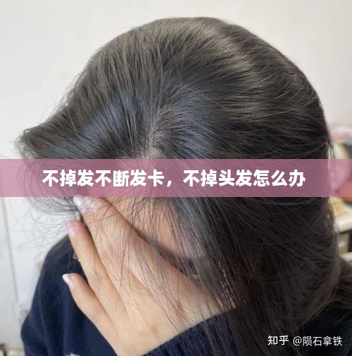 不掉發(fā)不斷發(fā)卡，不掉頭發(fā)怎么辦 