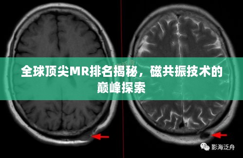 全球頂尖MR排名揭秘，磁共振技術(shù)的巔峰探索
