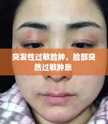 突發(fā)性過敏臉腫，臉部突然過敏腫脹 
