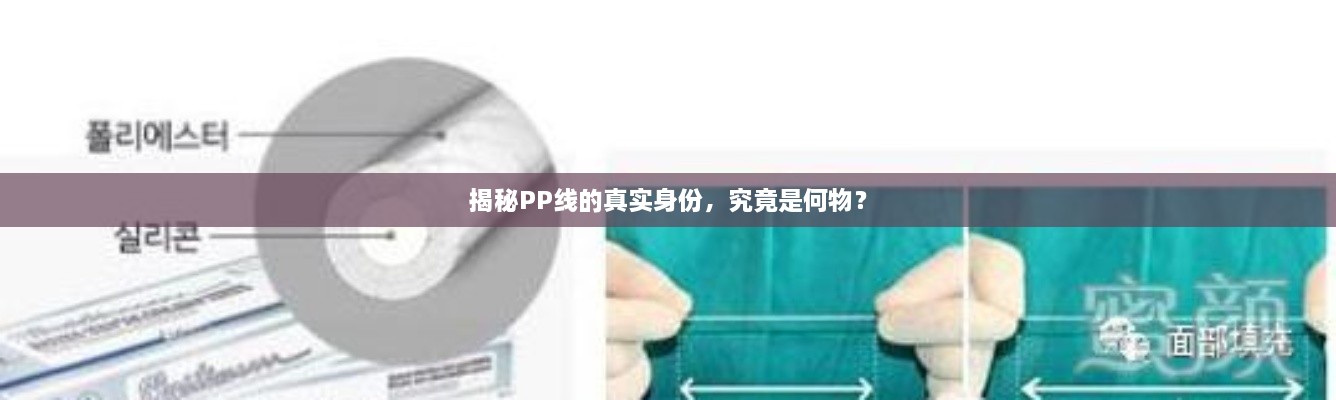 揭秘PP線的真實身份，究竟是何物？