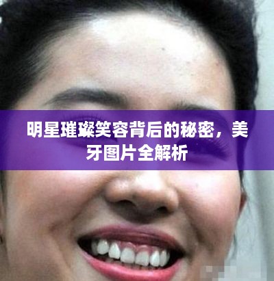 明星璀璨笑容背后的秘密，美牙圖片全解析