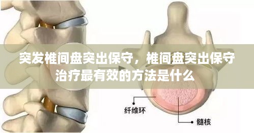 突發(fā)椎間盤突出保守，椎間盤突出保守治療最有效的方法是什么 