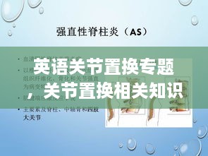 英語(yǔ)關(guān)節(jié)置換專題，關(guān)節(jié)置換相關(guān)知識(shí) 