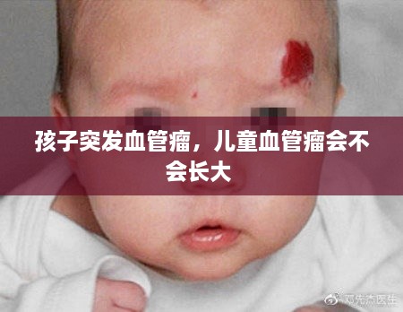 孩子突發(fā)血管瘤，兒童血管瘤會不會長大 