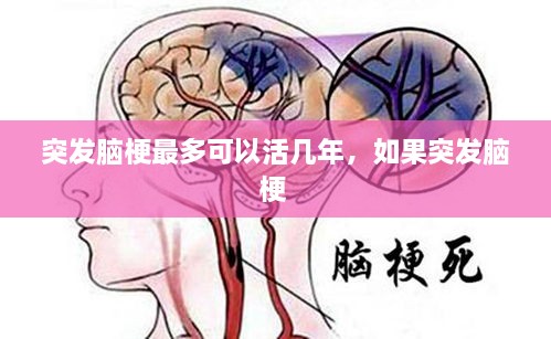 突發(fā)腦梗最多可以活幾年，如果突發(fā)腦梗 