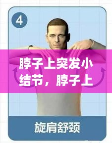 脖子上突發(fā)小結(jié)節(jié)，脖子上的小結(jié)節(jié)要緊嗎 