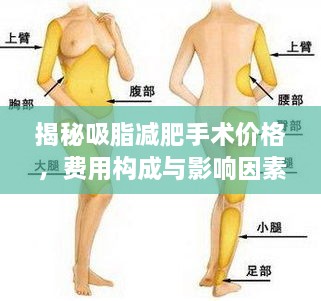 揭秘吸脂減肥手術價格，費用構成與影響因素全解析